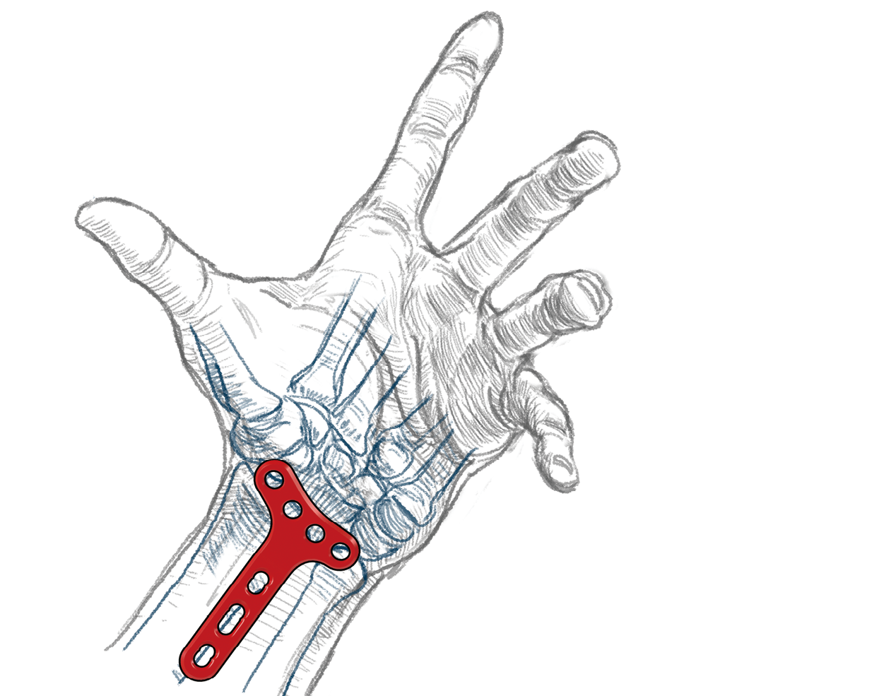 ORTHOPAEDIC
